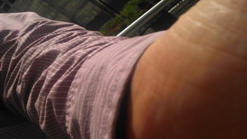 El brazo