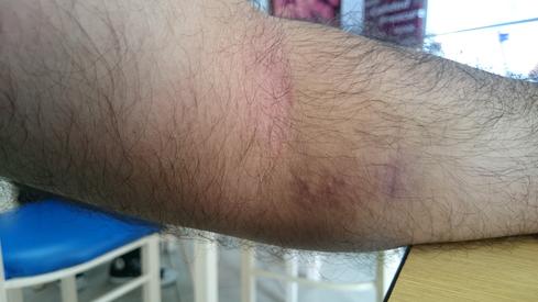 Después de donar sangre