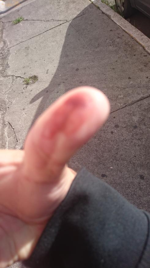 Mi dedo con tinta indeleble